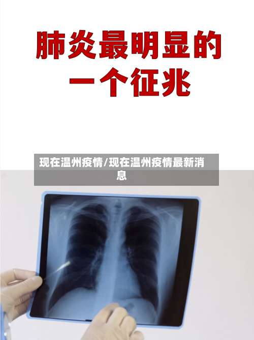 现在温州疫情/现在温州疫情最新消息