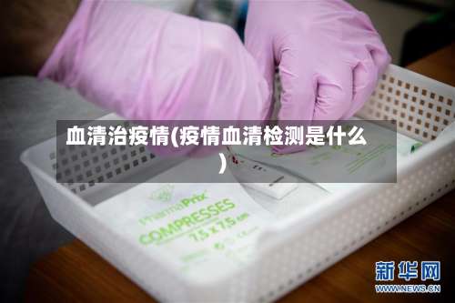 血清治疫情(疫情血清检测是什么)