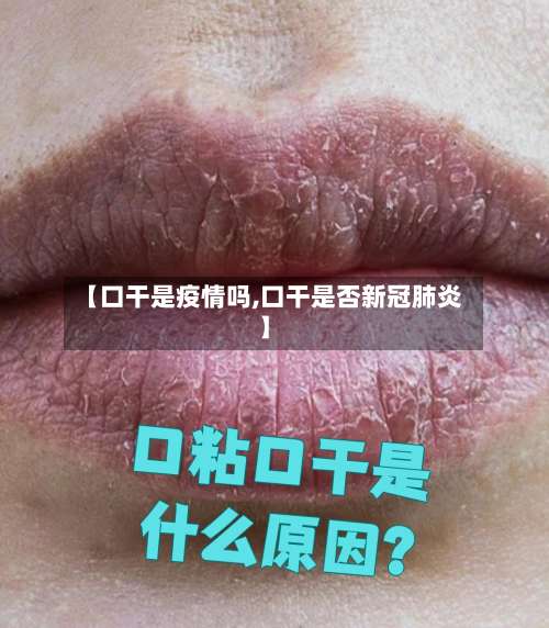 【口干是疫情吗,口干是否新冠肺炎】-第3张图片