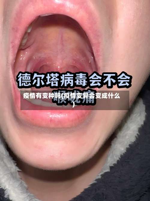 疫情有变种吗(疫情变异会变成什么)