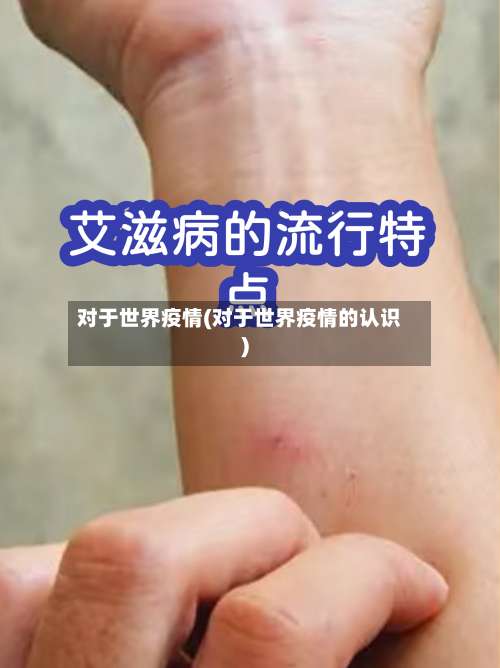 对于世界疫情(对于世界疫情的认识)-第3张图片