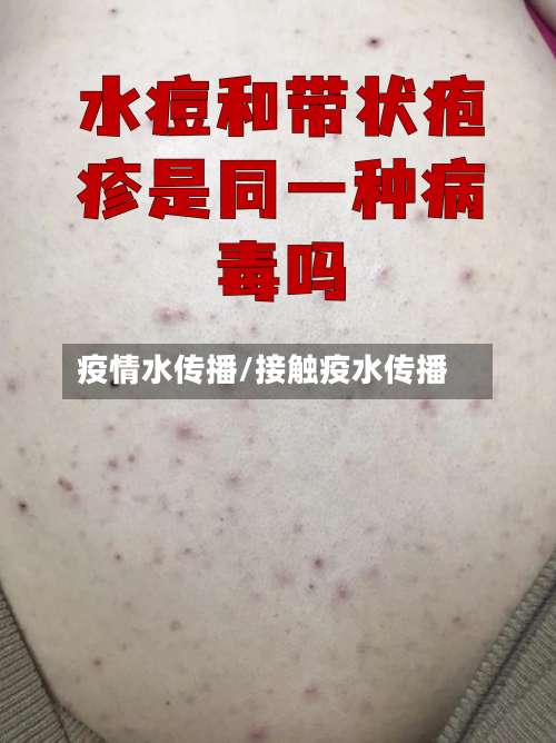 疫情水传播/接触疫水传播-第2张图片